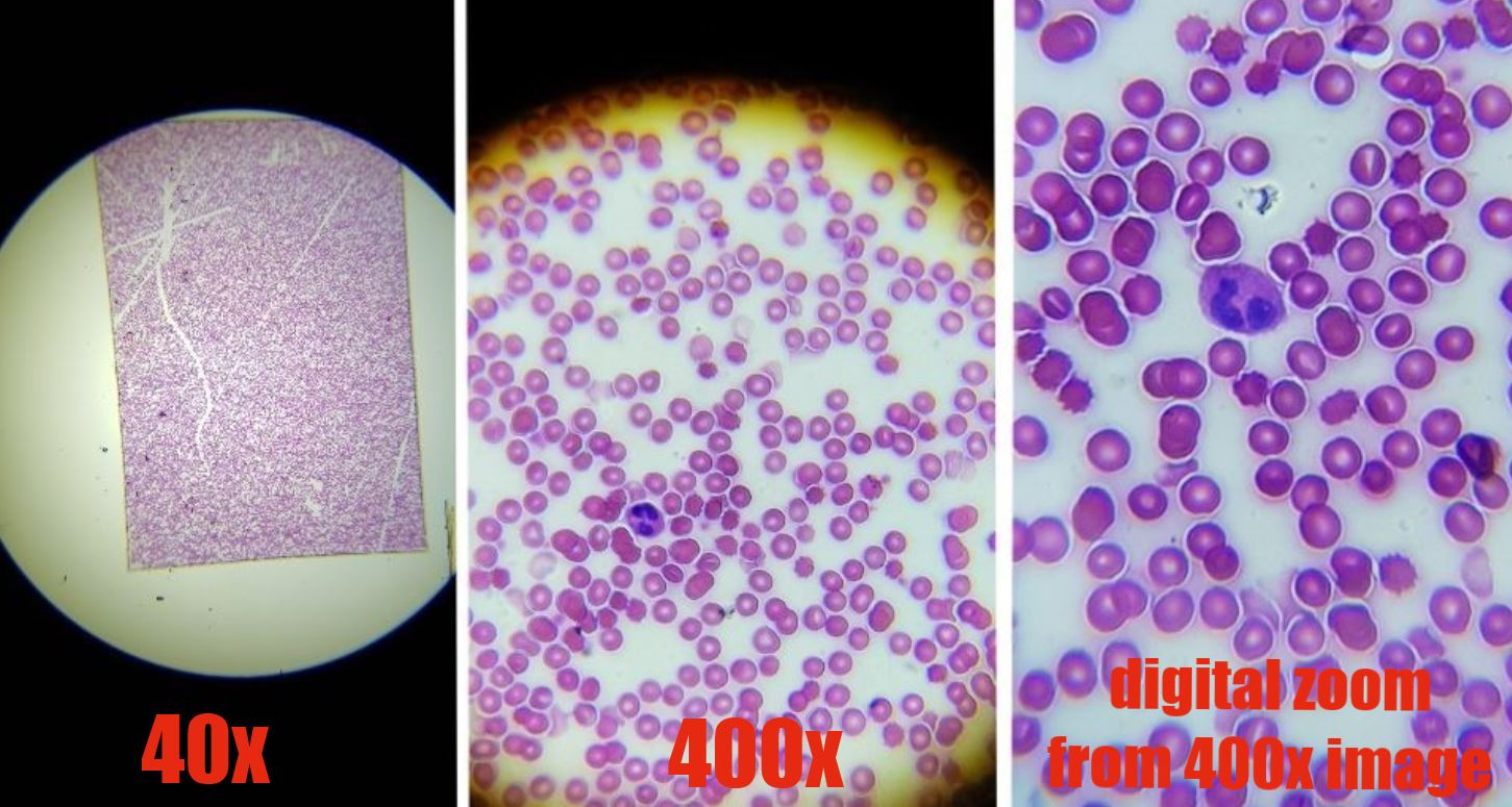 microscope view of blood